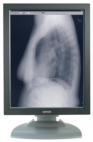 Barco Coronis 3MP 1H GS Diagnostic Medical Display Monitor MXRT-5450 Card