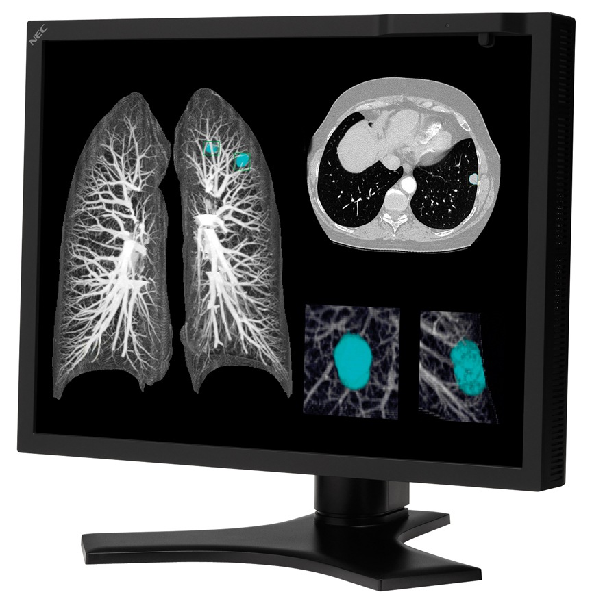 NEC MultiSync MD213MC - LCD monitor - 3MP - color - 21.3"