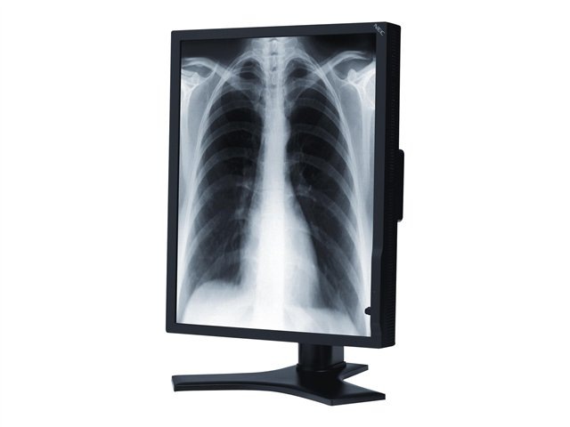NEC MultiSync MD213MG - LCD monitor - 3MP - grayscale - 21.3"