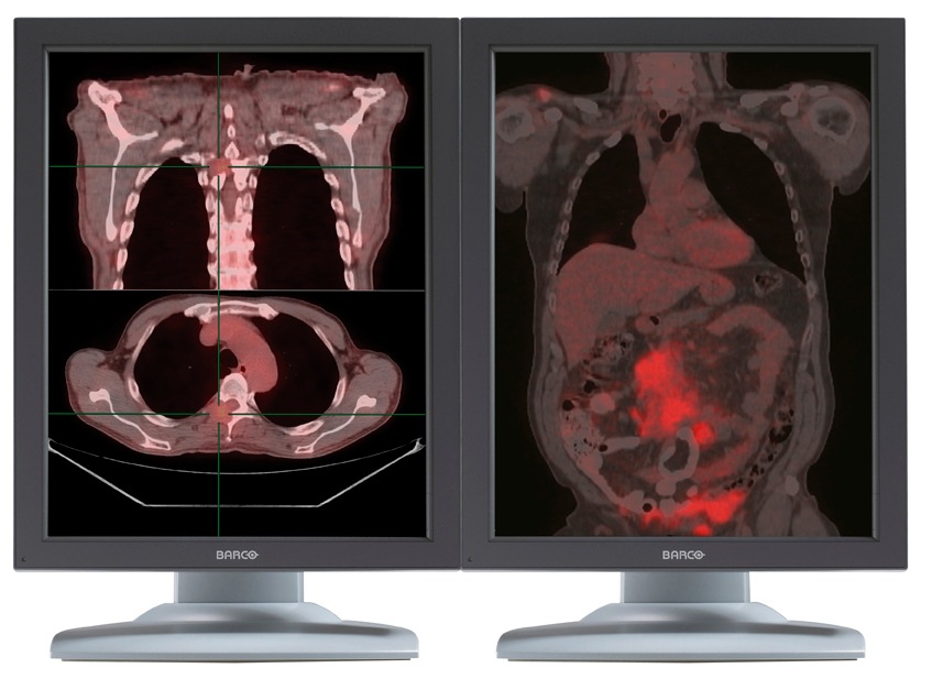 Barco Nio 3MP 2H Color High Bright Diagnostic Medical Display MXRT5450