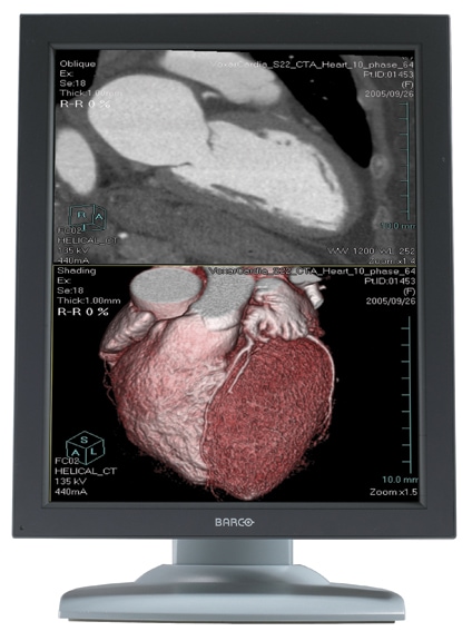 Barco Nio 3MP 1H Color High Bright Diagnostic Medical Display MXRT5450