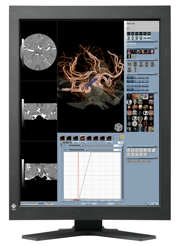 EIZO RadiForce RX320 - LCD display - 3MP - color - TFT - 21.2"