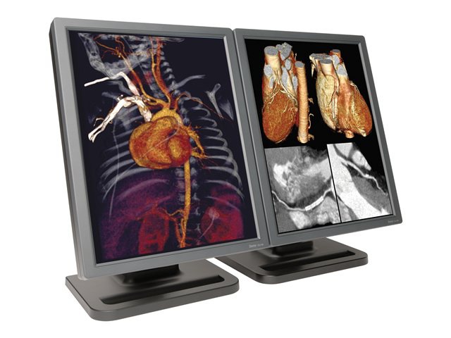 E3cHB Dual Color Diagnostic Display Medical Monitor, w/ Quadro 2000D