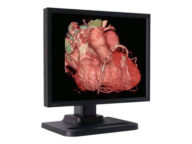 Single Color Diagnostic Display Medical Monitor, w/ Quadro NVS300 x16
