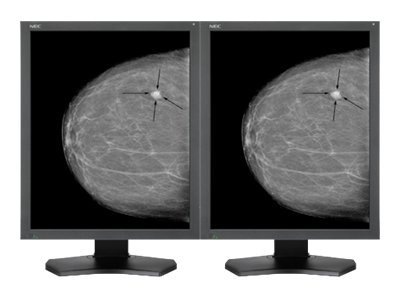 NEC MultiSync MDG5-BNDL2 - LCD monitor - 5MP - grayscale - 21.3"