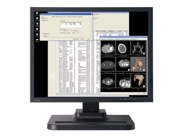 NDS GX2MP PLUS SGL COLOR DIAG DISP