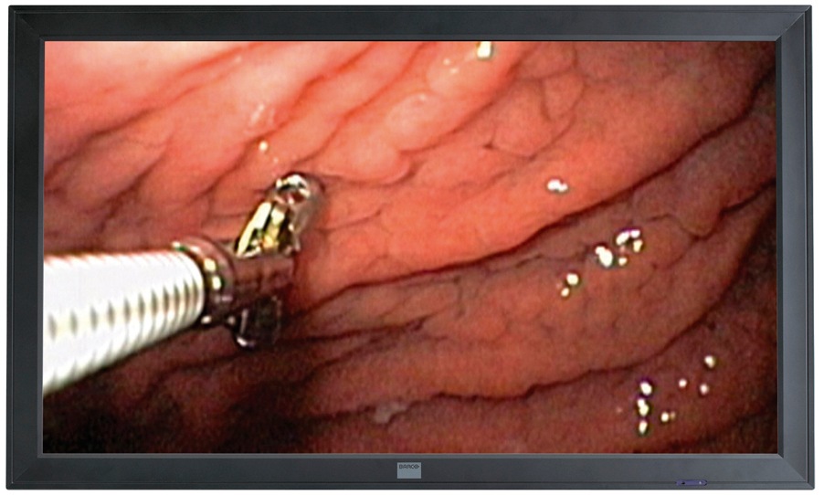 Barco 42’ Medical LCD Display