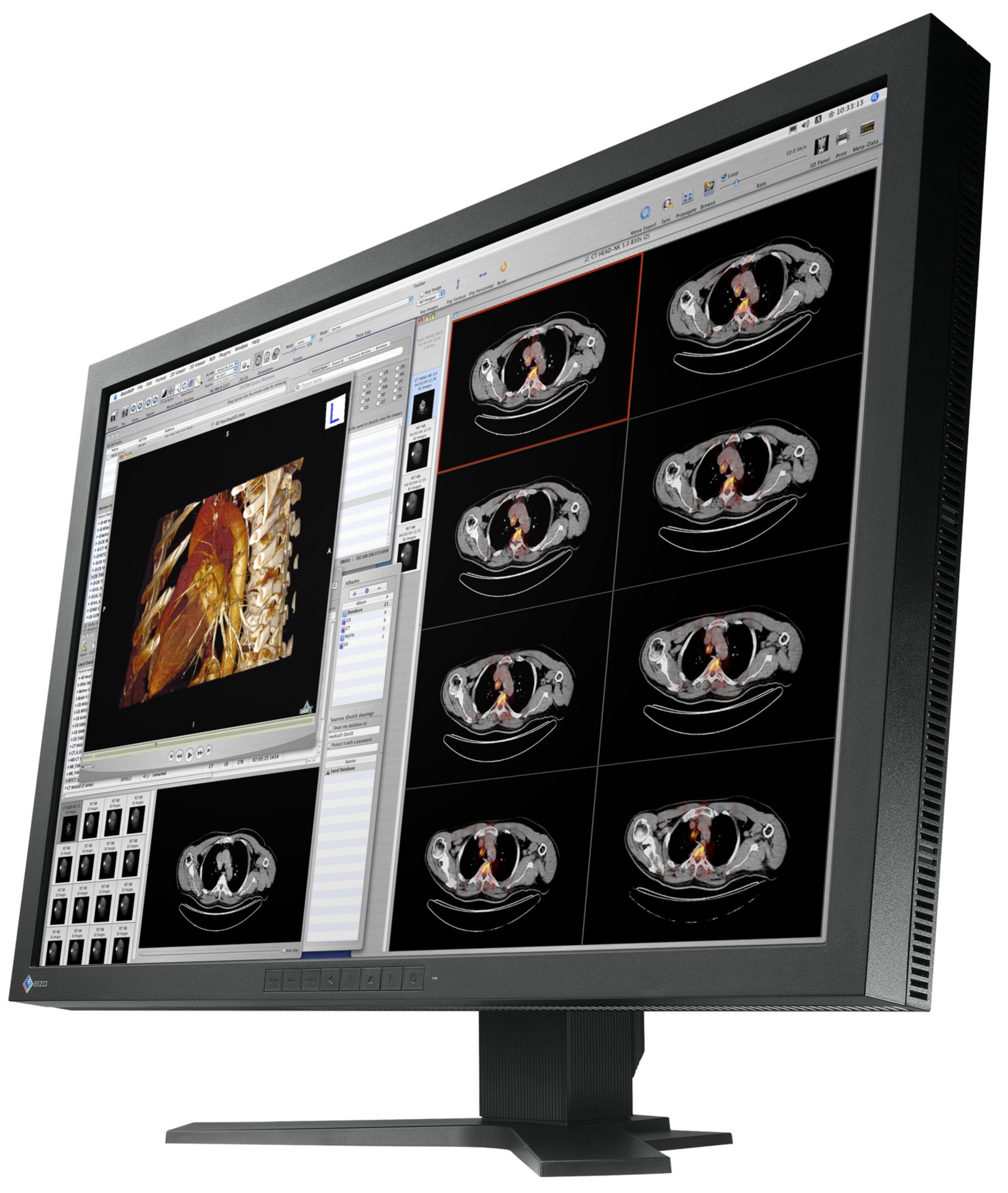 EIZO FlexScan MX MX300W - LCD monitor - 4MP - color - 29.8"
