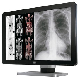 Barco Coronis Color Fusion 6MP Diagnostic Display, 30”, MXRT5200 Card


