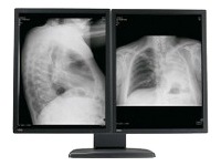 Barco Coronis 3MP - flat panel display - 2 x 3MP - grayscale - TFT - 20.8" - with Barco MXRT-7100 graphics adapter
