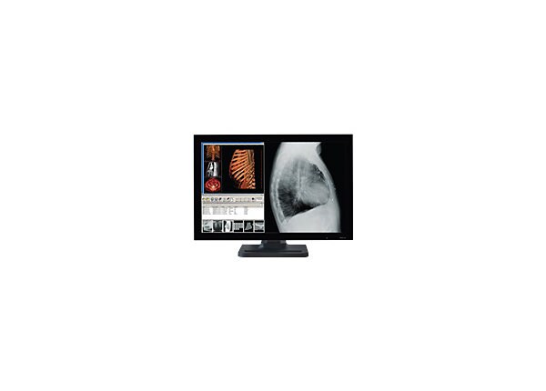 Dome by NDSsi E4c, 4MP Color, 30-inch, No VC, Monitor               
