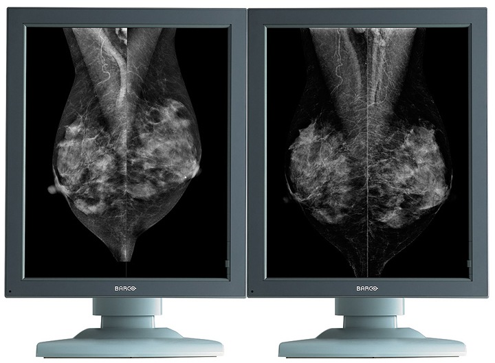 Barco Coronis 5MP Mammo HD 2HD GS Diagnostic Medical Display Monitors PCIE