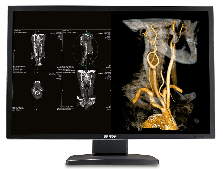 Barco Nio 4MP CLR Fusion Diagnostic Medical Display Monitor System MXRT5200