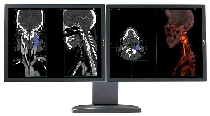 Barco Coronis 2MP 2HD Color Diagnostic Medical Display Monitor Sys MXRT5200