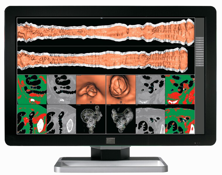 Barco Coronis 6MP Color Fusion Diagnostic Medical Display Monitor MXRT5200