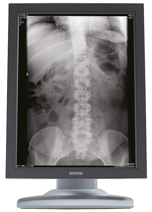 Barco Nio 3MP 1HD GS Diagnostic Medical Display Monitor System w/MXRT5200