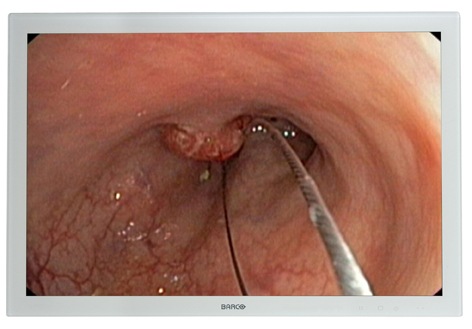 Barco Color 24" Surgical Medical Display Lcd Monitor With HDsdi MDSC-2124