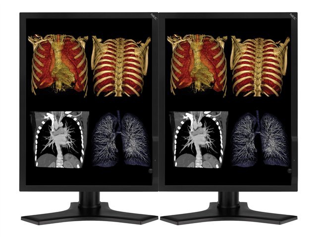 NEC MultiSync MDC3MP - LCD monitor - 3MP - color - 21.3" - with AMD V5800 Dual DVI PCIe video card