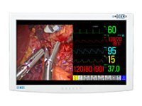 NDSsi Radiance 55”, LED, 240 Hz, HD Surgical Display Monitor with Full MMI