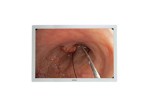 Barco MDSC-2124 Surgical 24” HDSDI Display protective screen