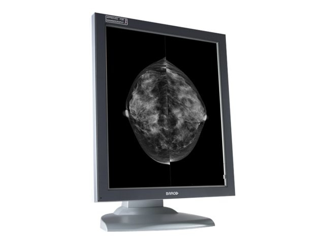 Barco Coronis 5MP 2H Mammo BB Diagnostic Medical Display Monitor
