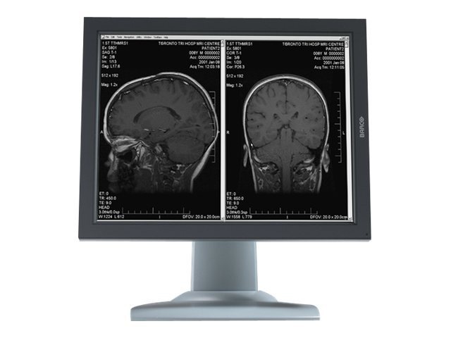 Barco Nio 2MP 2H GS Diagnostic Medical Display Monitor MXRT-5450 1GB Card