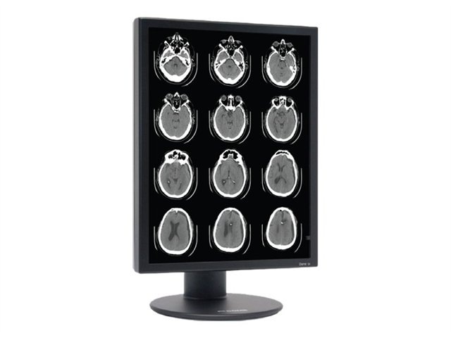 S3 Dual Grayscale Diagnostic Display Medical Monitor, w/ Quadro 2000D