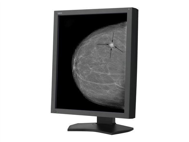 NEC MD215MG - LCD monitor - 5MP - grayscale - 21.3"