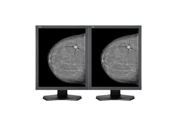 NEC MultiSync MDG5-BNDL2 - LCD monitor - 5MP - grayscale - 21.3"