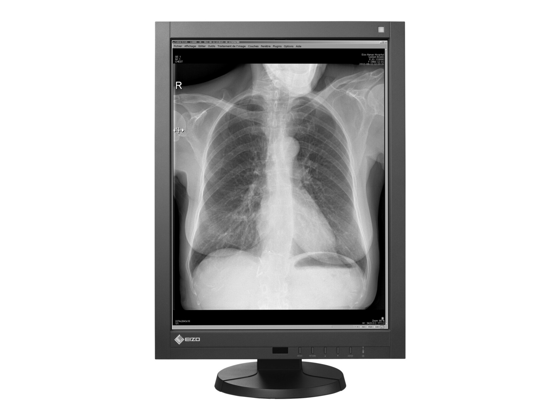 EIZO RadiForce GX340-CL-P - LCD monitor - 3MP - grayscale - 21.3"