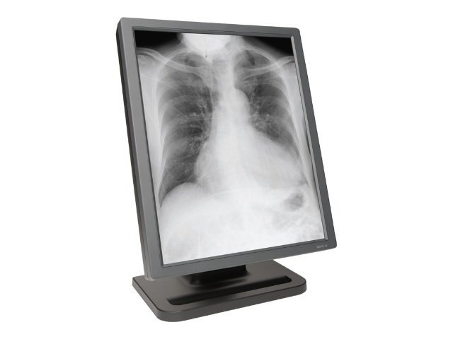 E3 Dual Grayscale Diagnostic Display Medical Monitor, w/ Quadro 600