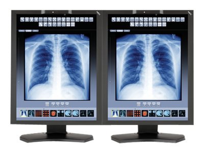 NEC MDC3-BNDA1 - LED monitor - 3MP - color - 21.3" - with AMD FirePro W5000 dual DisplayPort Video Card