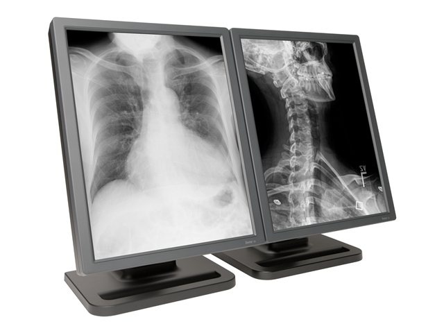 NDS Dome E3 - LCD monitor - 2 x 3MP - grayscale - 20.8" - with NVIDIA Quadro K2000D graphics adapter