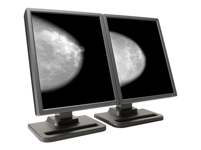 NDS Dome E5 - LCD monitor - 2 x 5MP - grayscale - 21.3" - with NVIDIA Quadro 2000D PCIe graphics adapter