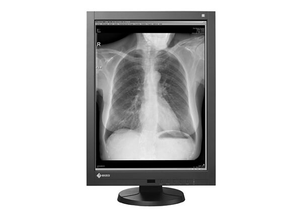 EIZO RadiForce GX340-CL Single Head - LED monitor - 3MP - grayscale - 21.3" - with Eizo MED-V5800 graphics adapter