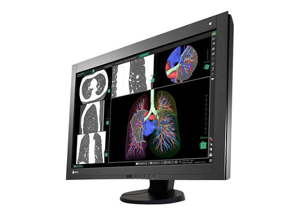 EIZO RadiForce RX440 - LED monitor - 4MP - color - 29.8"