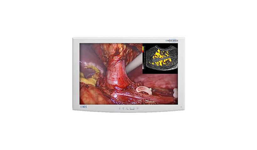 NDS Radiance G2 42" Color LED Display w/ Single Fiber