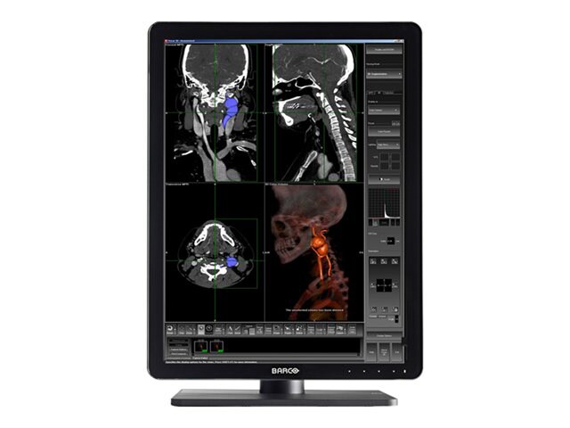 Barco Nio Color 3MP LED MDNC-3321 - LED monitor - 2 x 3MP - color - 21.3" - with MXRT-5450 3D PCIe Dual-DVI display
