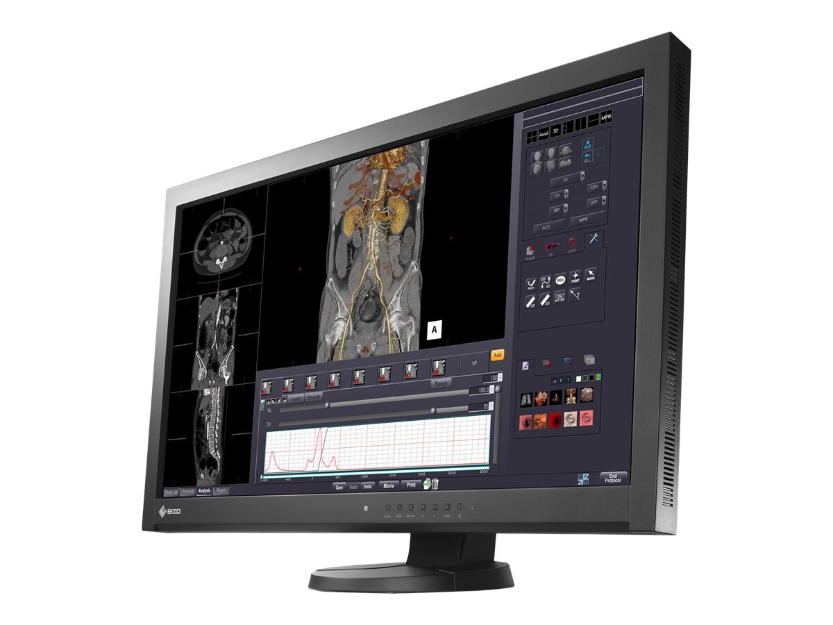 EIZO RadiForce MX270W-BK - LCD monitor - 3.7MP - color - 27"