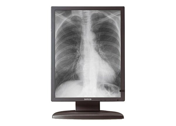 Barco Coronis 3MP - LCD monitor - 2 x 3MP - grayscale - 20.8" - with Barco MXRT-5400 graphics adapter
