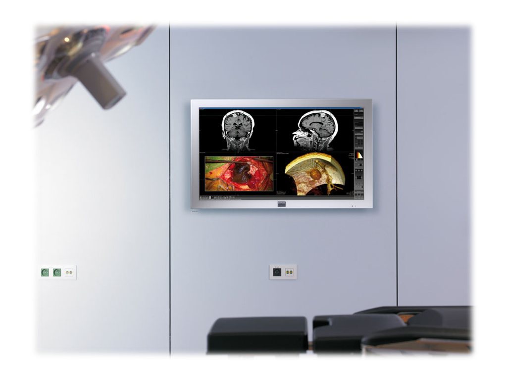 BARCO 42" MDSC-2242 LED FULL HD SURGICAL OR/ENDO DISPLAY K9307914
