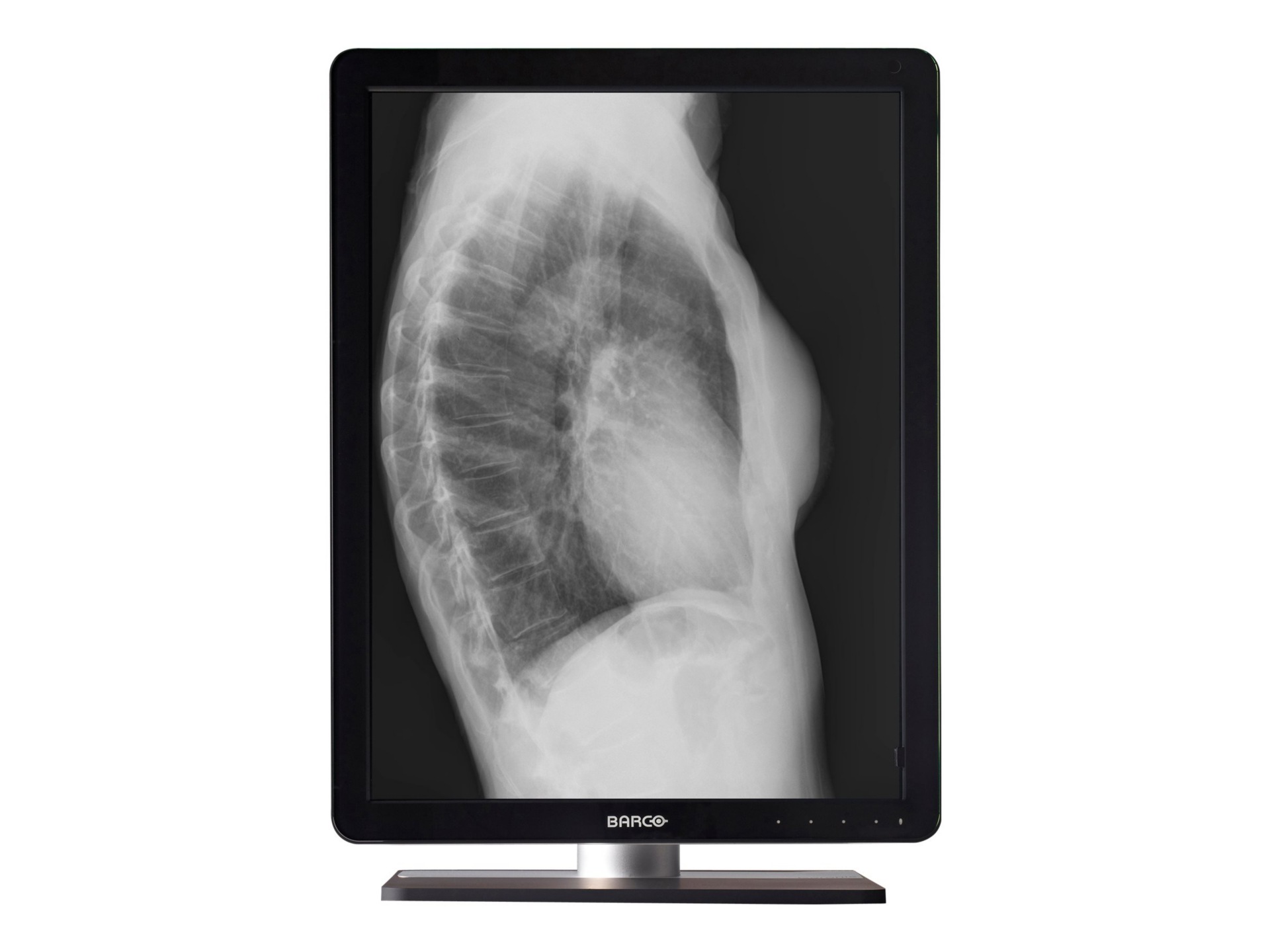 BARCO CORONIS 3MP LED GRAYSCALE DIAGNOSTIC DUAL-HEAD NO-CARD MDCG-3221