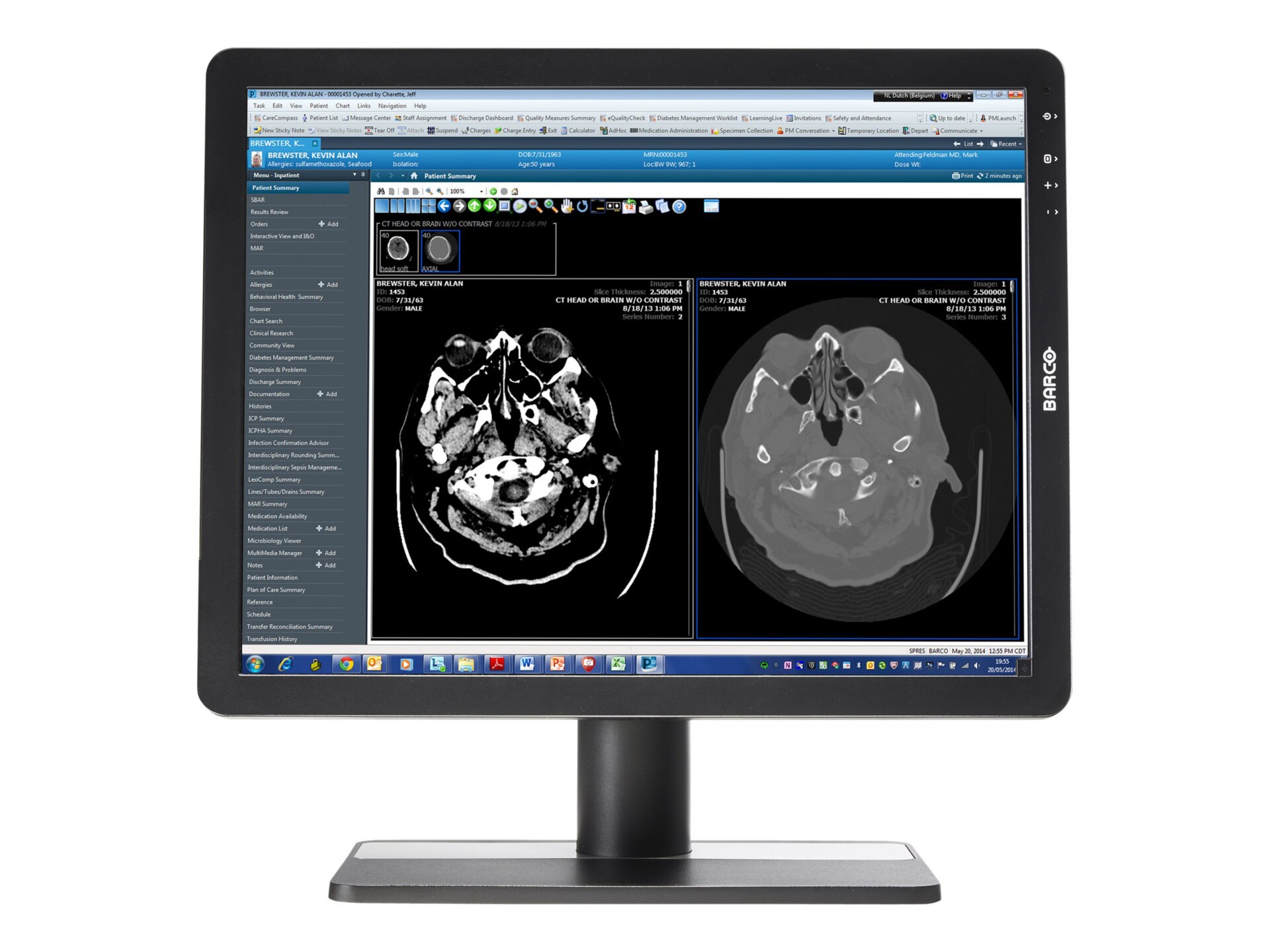 BARCO EONIS 21" MDRC-2221 CLR 2MP LED 4:3 CLINICAL DICOM REVIEW DISPLAY