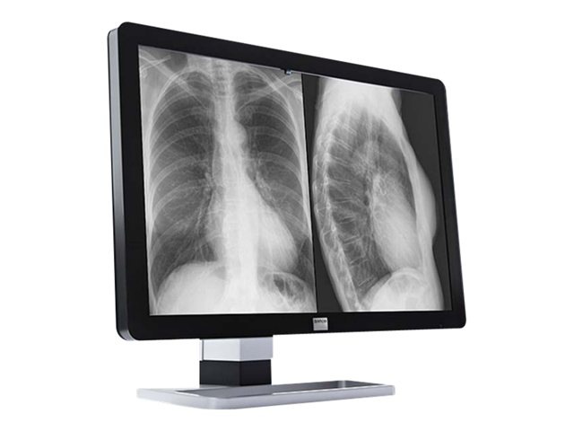 Barco Coronis Fusion 10MP MDCG-10130 - LCD monitor - 10MP - grayscale - 29.6" - with Barco MXRT-5500 graphics adapter