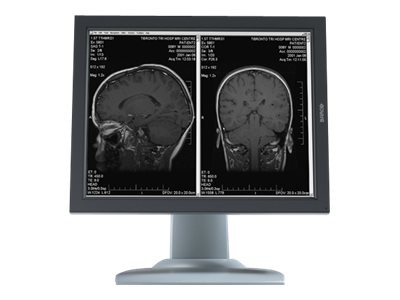 Barco Nio 2MP MDNG-2121 - LCD monitor - 4 x 2MP - grayscale - 21.3" - with Barco MXRT-5550 graphics adapter
