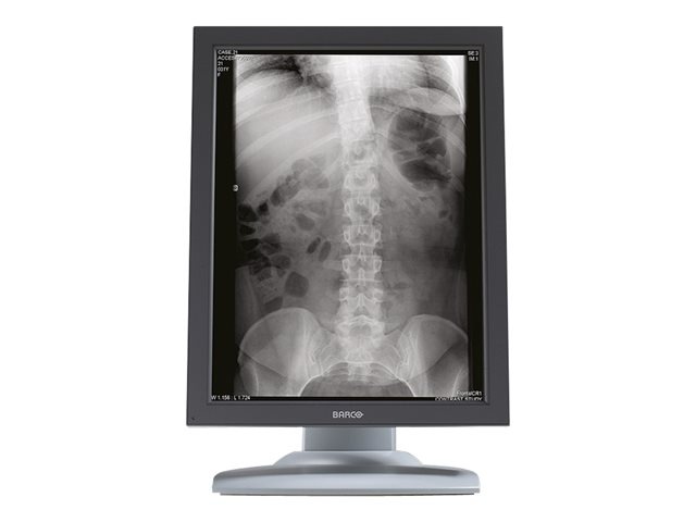 Barco Nio 3MP E-3620 MA - LCD monitor - 2 x 3MP - grayscale - 20.8" - with Barco MXRT-5550 graphics adapter