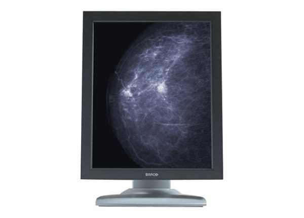 Barco Nio 5MP MDNG-6121 - LCD monitor - 4 x 5MP - grayscale - 21.3" - with Barco MXRT-5550 graphics adapter