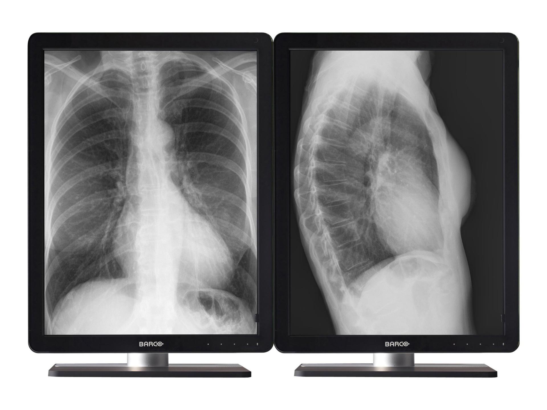 BARCO CORONIS 3MP LED GRAYSCALE DIAGNOSTIC SINGLE-HEAD MXRT-5600 MDCG-3221