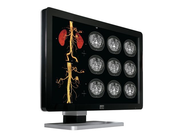 Barco Coronis Fusion 4MP DL (MDCC-4130) - LCD monitor - 4MP - color - 30" - with Barco MXRT-5550 graphics adapter