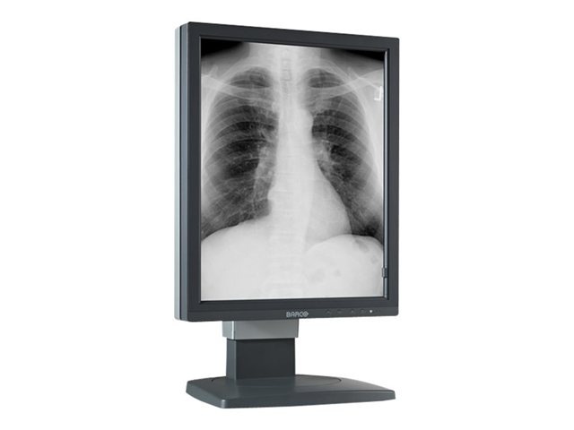Barco Coronis 5MP MDCG-5121 - LCD monitor - 5MP - grayscale - 21.3" - with Barco MXRT-5500 graphics adapter